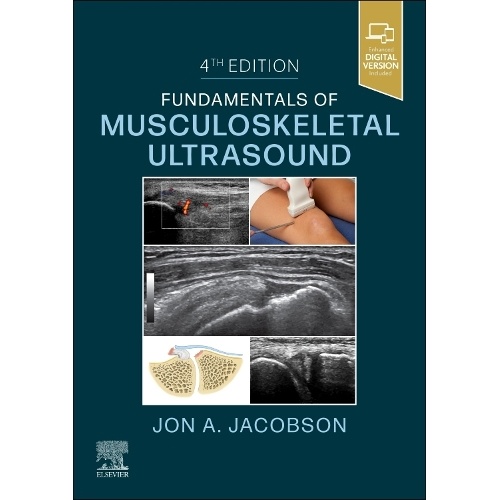 Fundamentals of Musculoskeletal Ultrasound
