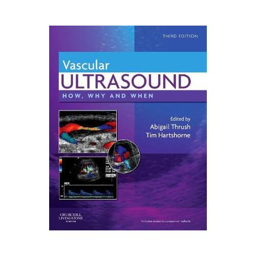 Vascular Ultrasound : How, Why and When