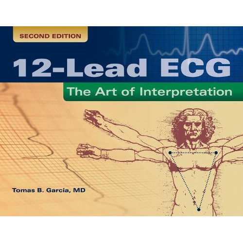 12-Lead ECG: the Art of Interpretation: The Art of Interpretation