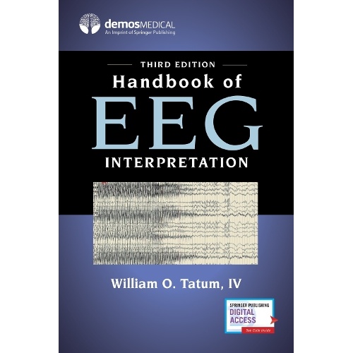 Handbook of EEG Interpretation