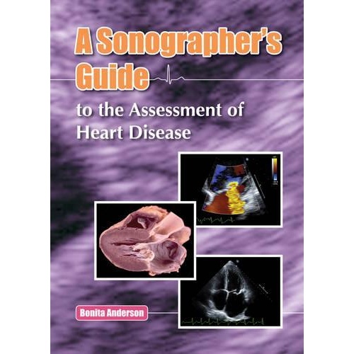 A Sonographers Guide to the Assessment of Heart Disease