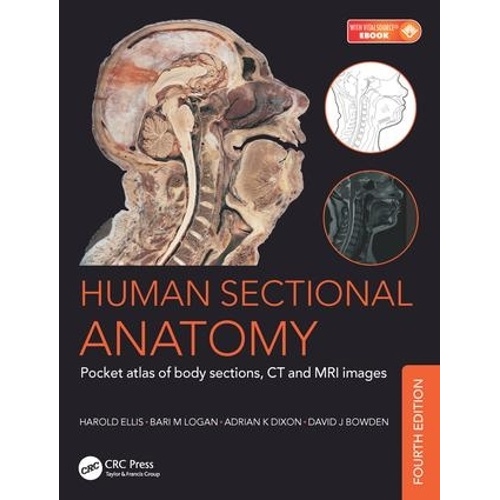 Human Sectional Anatomy: Pocket atlas of body sections, CT and MRI images, Fourth edition